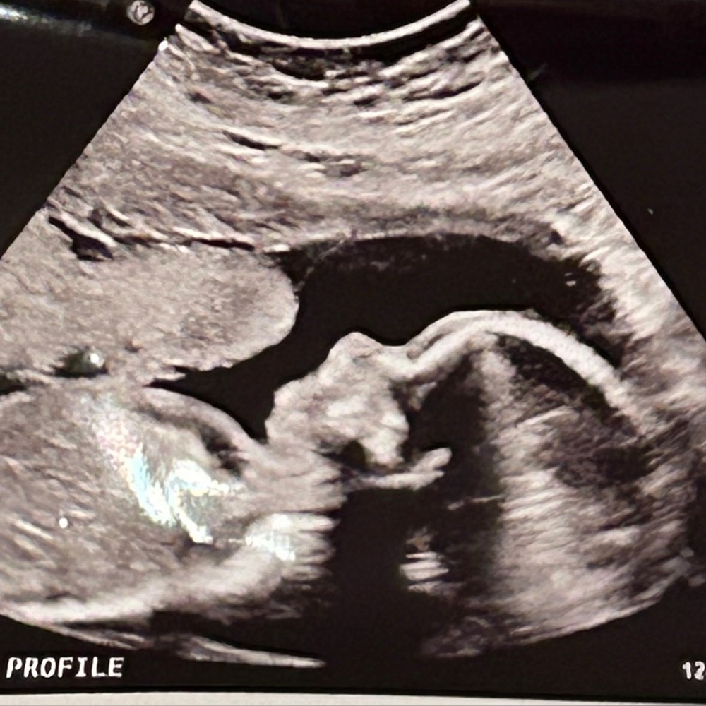 taking a hiatus because baby #7 🪴